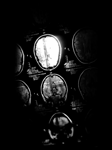 Brain Ray