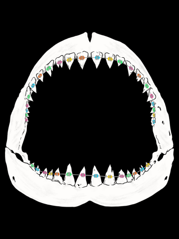 JAWS BRACES